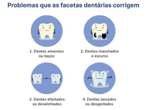 Problemas que as facetas dentarias corrigem-orofacial